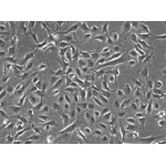 Human Small Intestine Microvascular Endothelial Cells (HSIMEC)